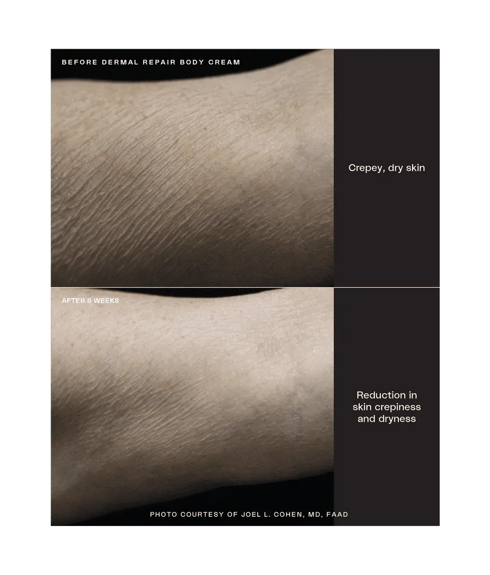 Sente Dermal Repair Body Cream